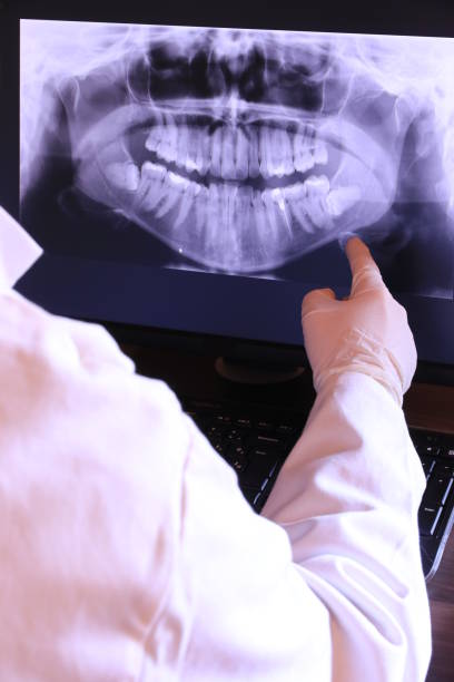 Best Emergency Dental Care for Broken or Chipped Teeth in New Waverly, TX