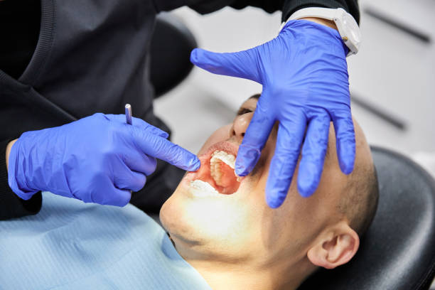 Best Emergency Dental Care for Broken or Chipped Teeth in New Waverly, TX