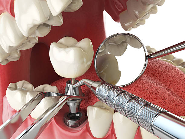 Best After-Hours Dental Trauma Care in New Waverly, TX